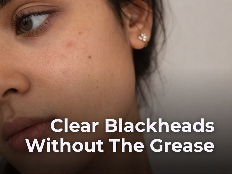 Do Blackhead Products Make You More Oily? Here's the Smarter Approach that Works