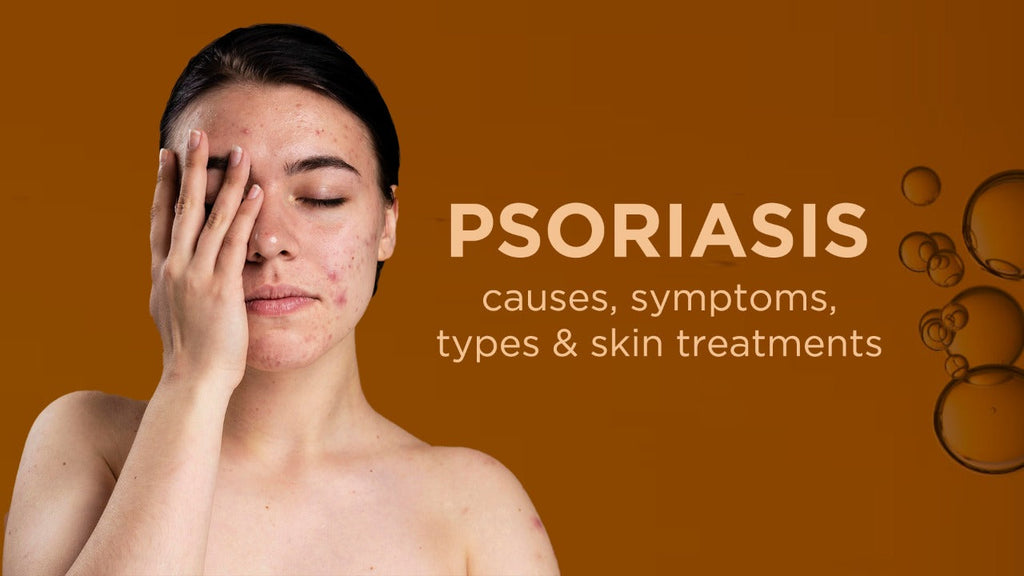 Psoriasis skin treatment