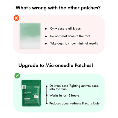 Self Dissolving Microneedle Acne Patches | 8 Patches | Slashed