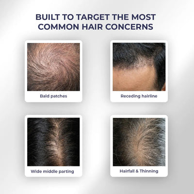 Anti-Hairfall Strength Duo | Shampoo & Conditioner | Reduces Hairfall & Frizz | shop all
