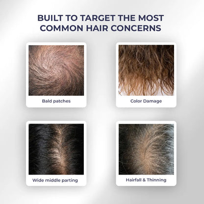 Anti Hairfall Strength Trio | Shampoo + Conditioner + Spray | Reduces Breakage & Hairfall