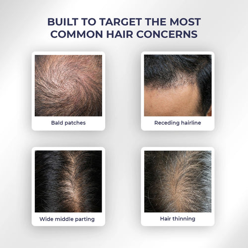 Rosemary Hair Growth Spray | 200 ml | Flash Sale