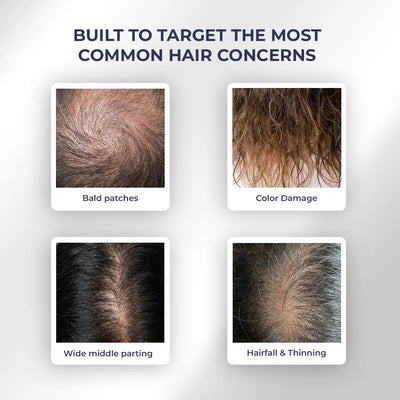 Hair Growth Duo | Shampoo & Serum | Reduces Hairfall & Supports New Hair Growth | combo