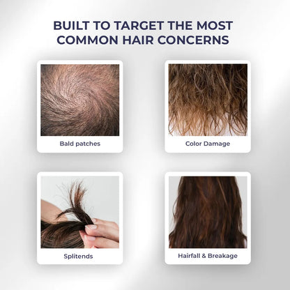 Advanced Hair Growth Kit | Oil + Shampoo + Conditioner + Spray + Serum | Reduces Hairfall & Boosts Hair Density