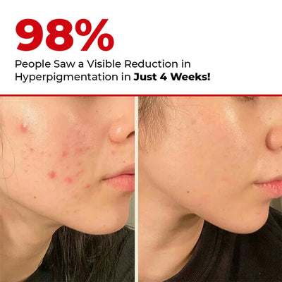 5 Antioxidant Serum Mini | Free Gift