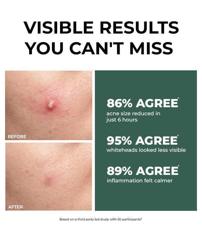 Product feature image 1