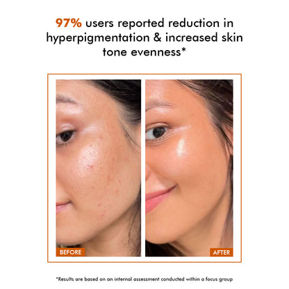 10% Vitamin C Serum | Radiance Booster | 30 ml