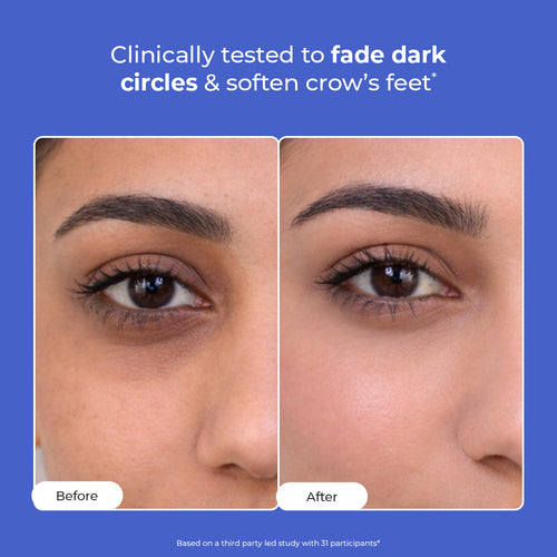 Retinol Peptide Eye Treatment Serum