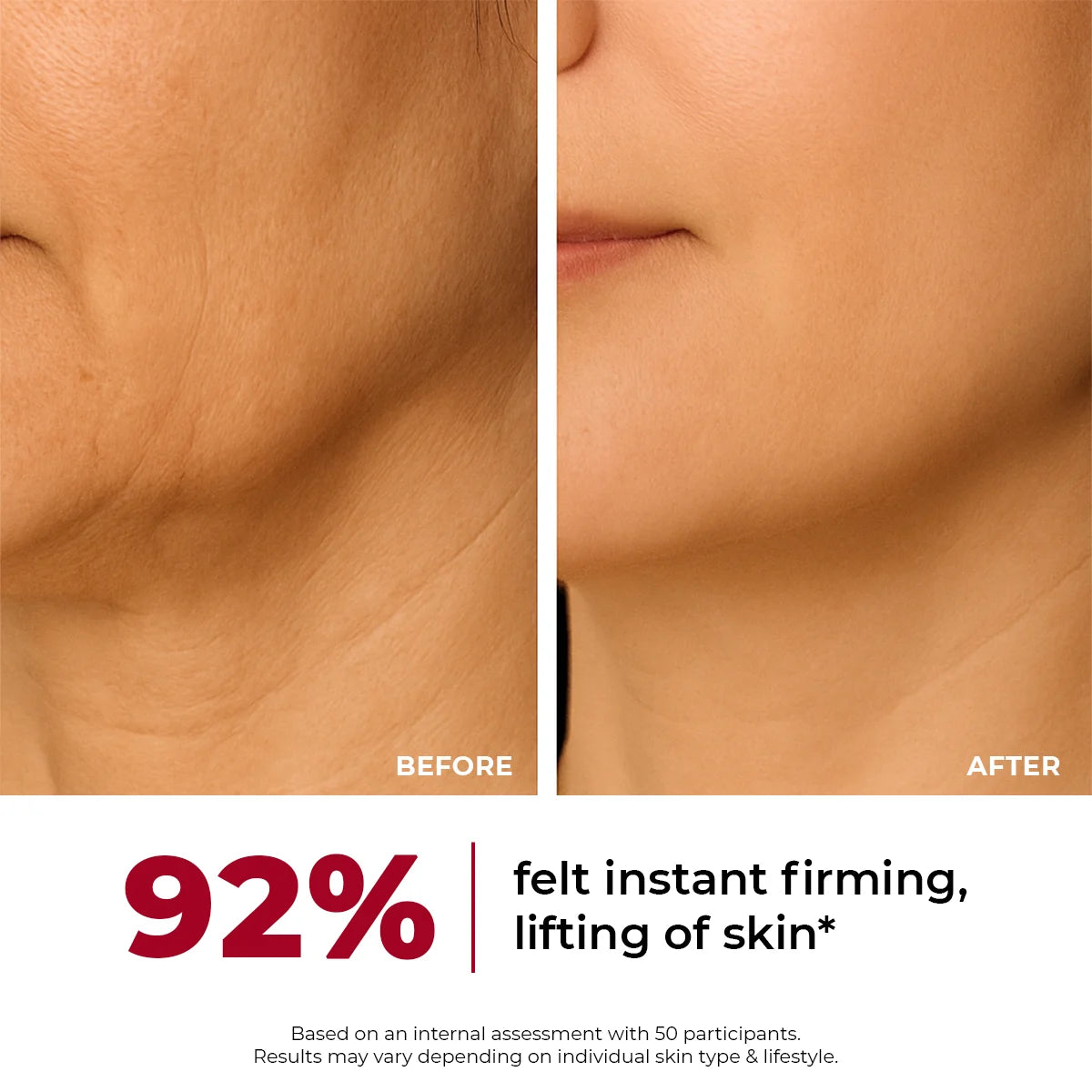 Collagen Jelly Cream | 50 gms | Flash Sale