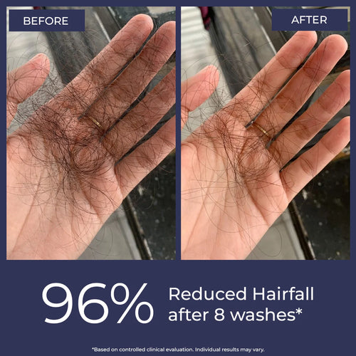 Anti-Hairfall Shampoo | Flash Sale