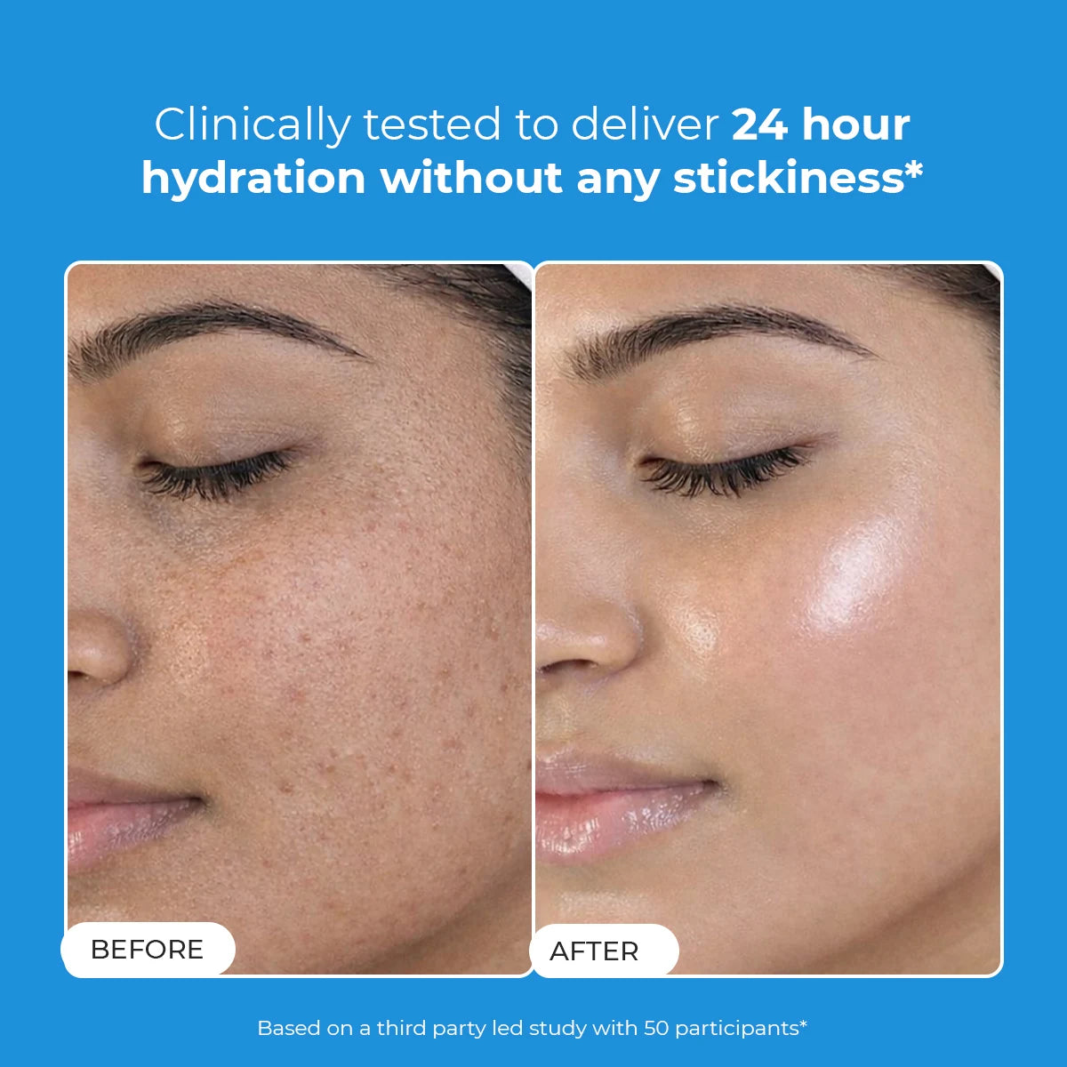 Hydro+ Multi Hyaluronic Acid Moisturiser | 100 gm