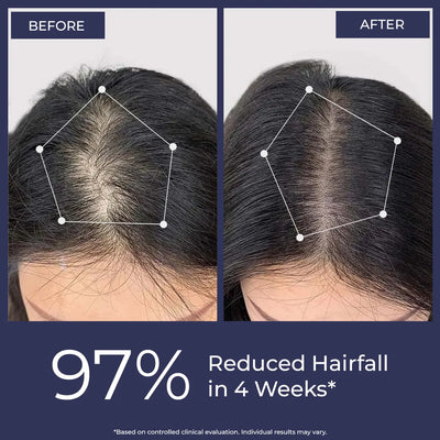 Anti-Hairfall Spray  | Super Saver Sale