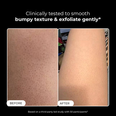 Skin Reset Exfoliating Bodywash | Special Deal