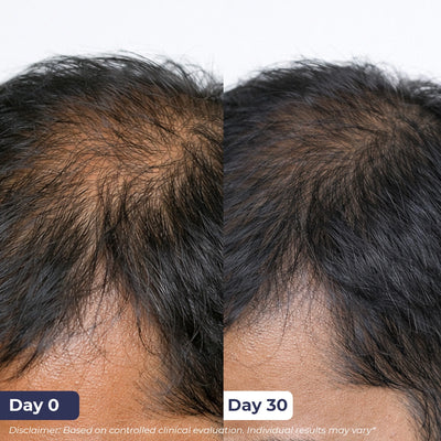 Anti-Hairfall Spray | Pre-Access