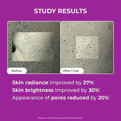 Berry Bright Niacinamide Face Mask | 50 gms