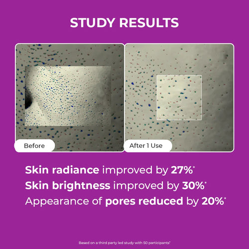 Berry Bright Niacinamide Face Mask | 50 gms | Flash Sale