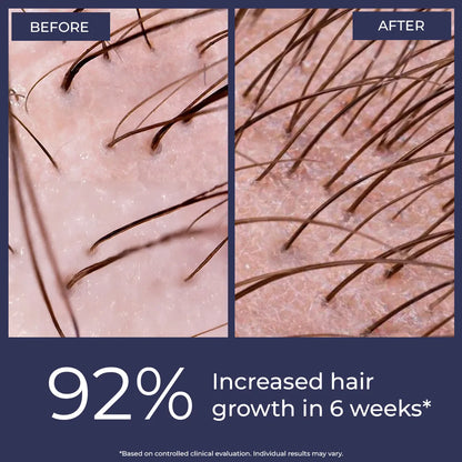 Rosemary Hair Growth Oil