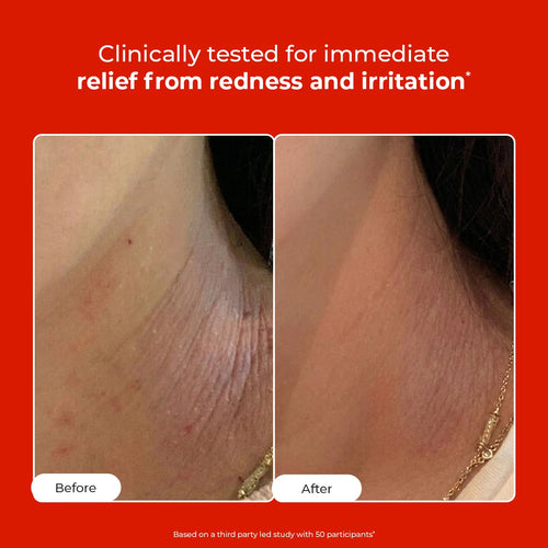 HOCL Daily Spray | Fights Body Odour, Acne & Irritation | Flash Sale