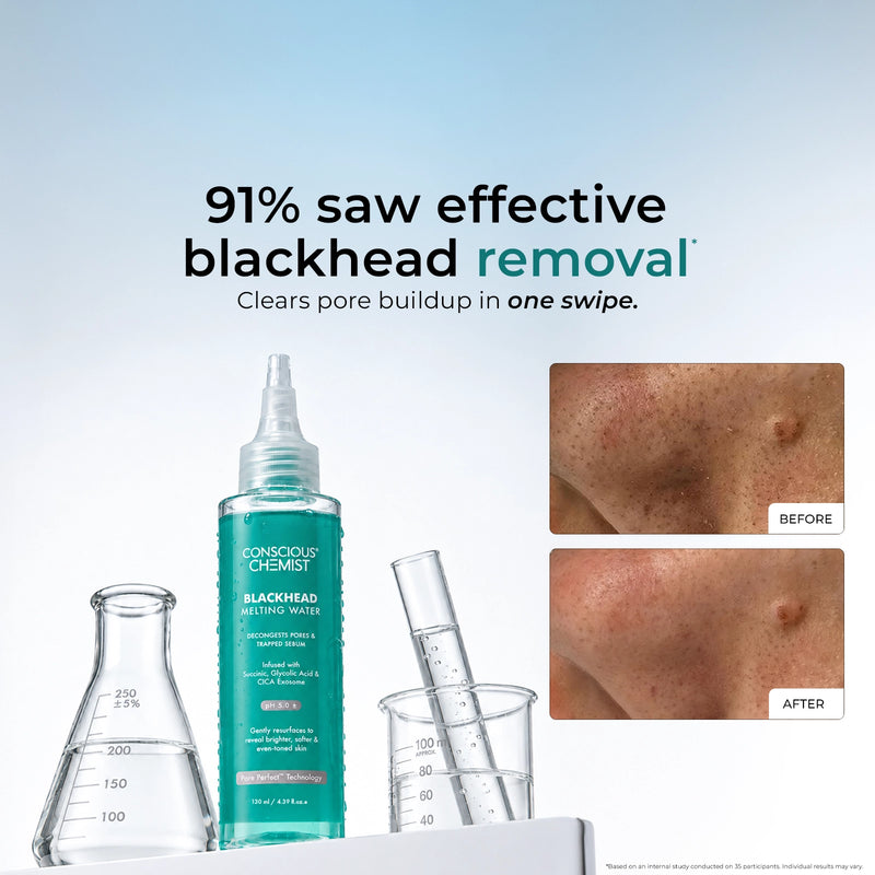 Blackhead melting water