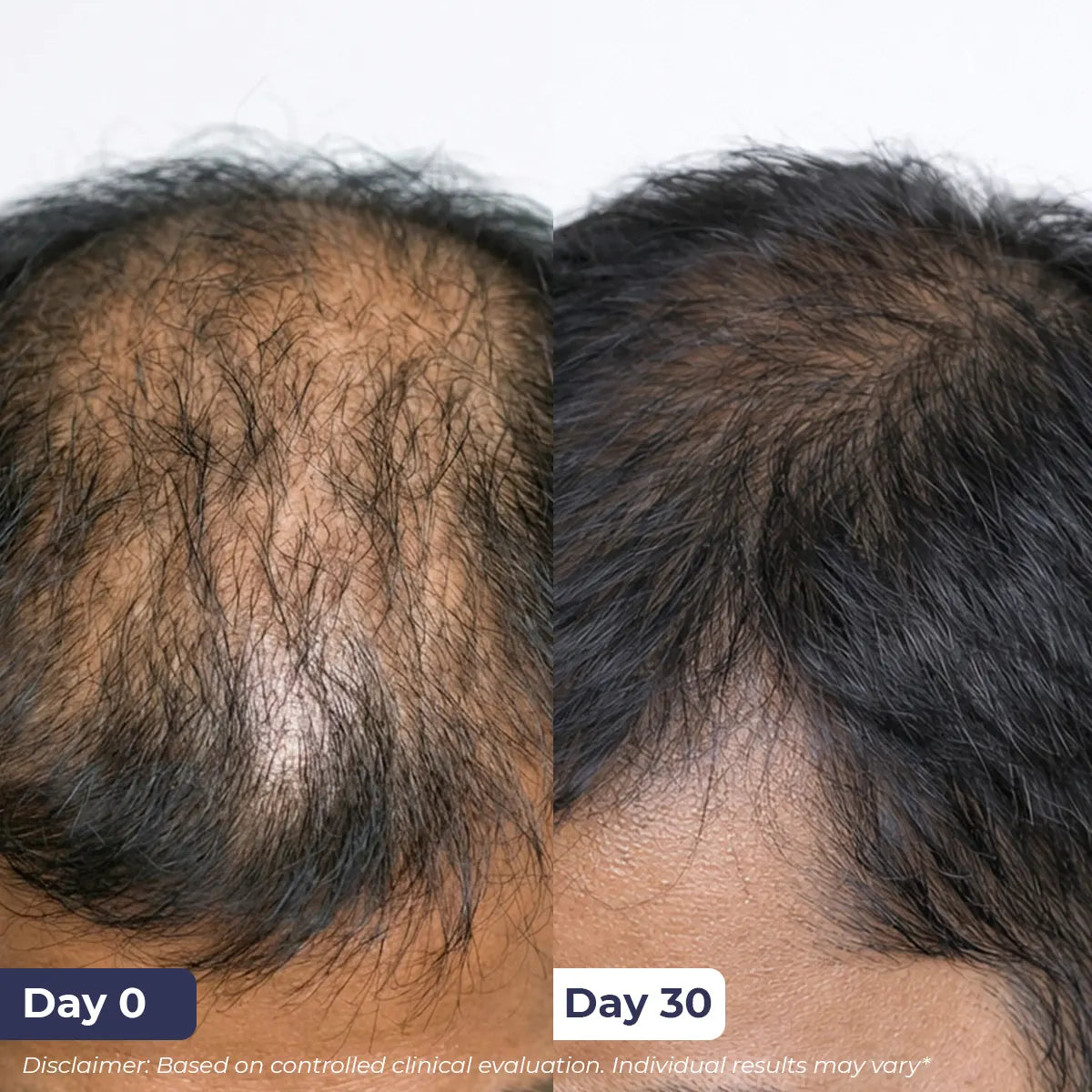 Rosemary Hair Growth Spray | 200 ml