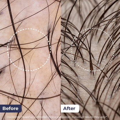 Rosemary Hair Growth Oil | 100 ml