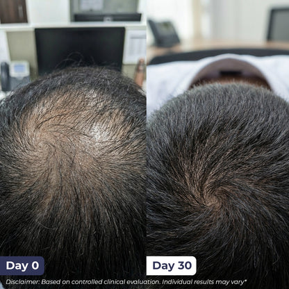 Hair Growth Serum | 30 ml