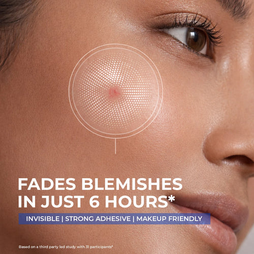 Microneedle Patch For Dark Spot Removal | 4 Patches | Flash Sale