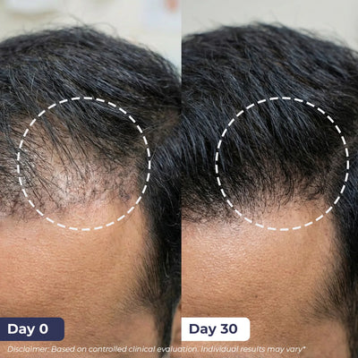 Essential Anti Hair Fall Kit | Reduce Breakage & Improve Strength | shop all
