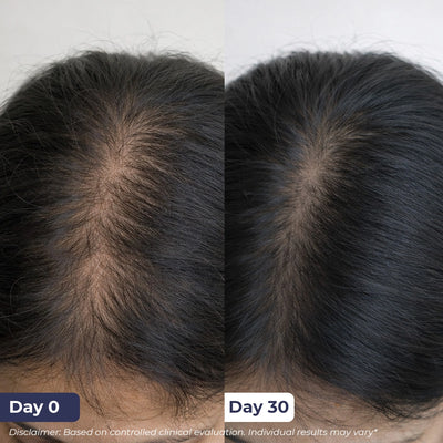Anti-Hairfall Spray | Pre-Access