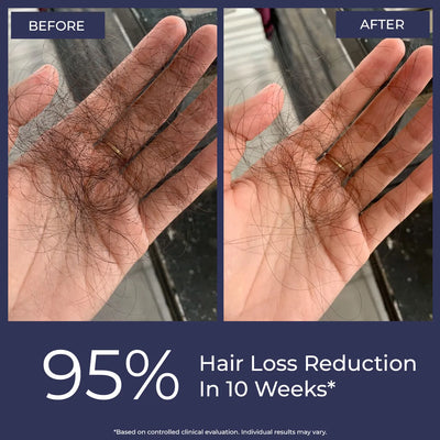 Rosemary Hair Growth Oil