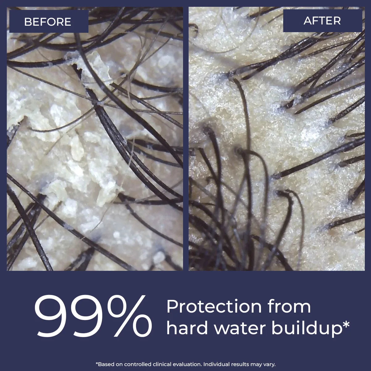 Anti-Hairfall Shampoo | 200 ml