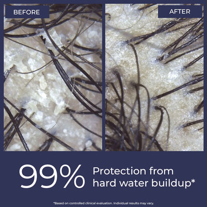 Anti-Hairfall Shampoo