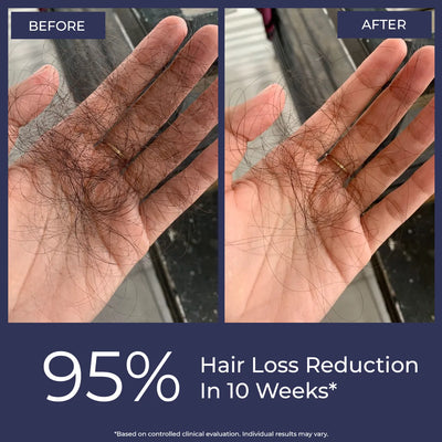 Hair Growth Serum | Super Saver Sale