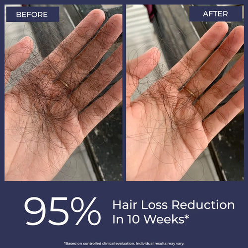 Hair Growth Serum