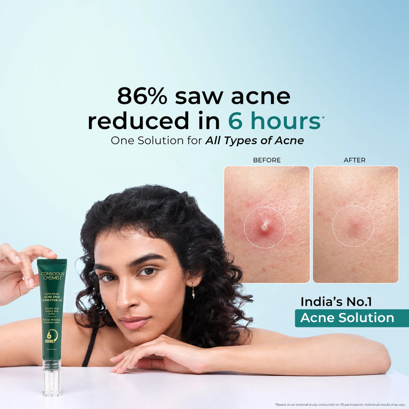 Acne dark spot corrector gel