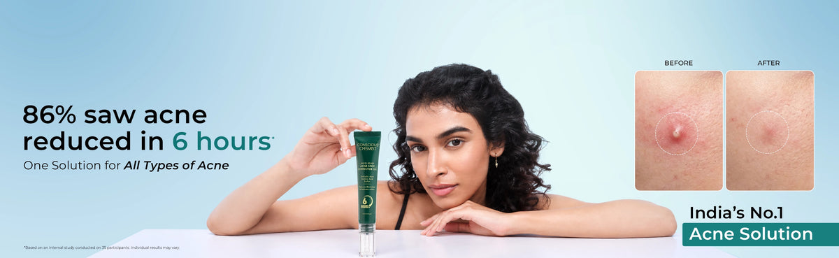 Acne dark spot corrector gel