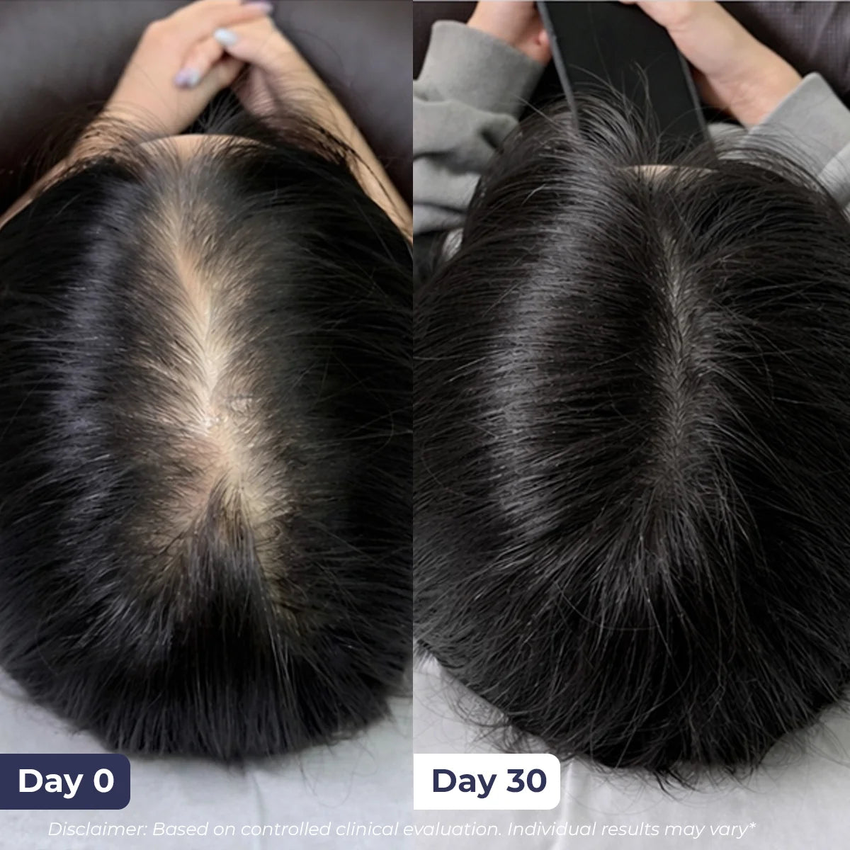 Hair Growth Serum | 30 ml