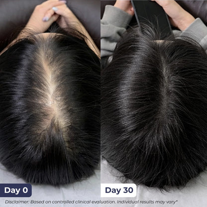 Hair Growth Serum | 30 ml