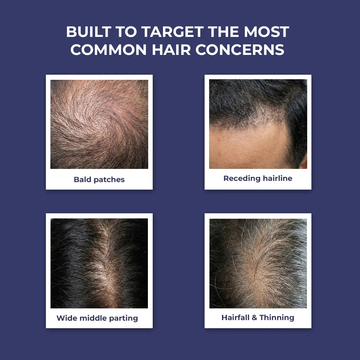 Anti-Hairfall Spray | 200 ml