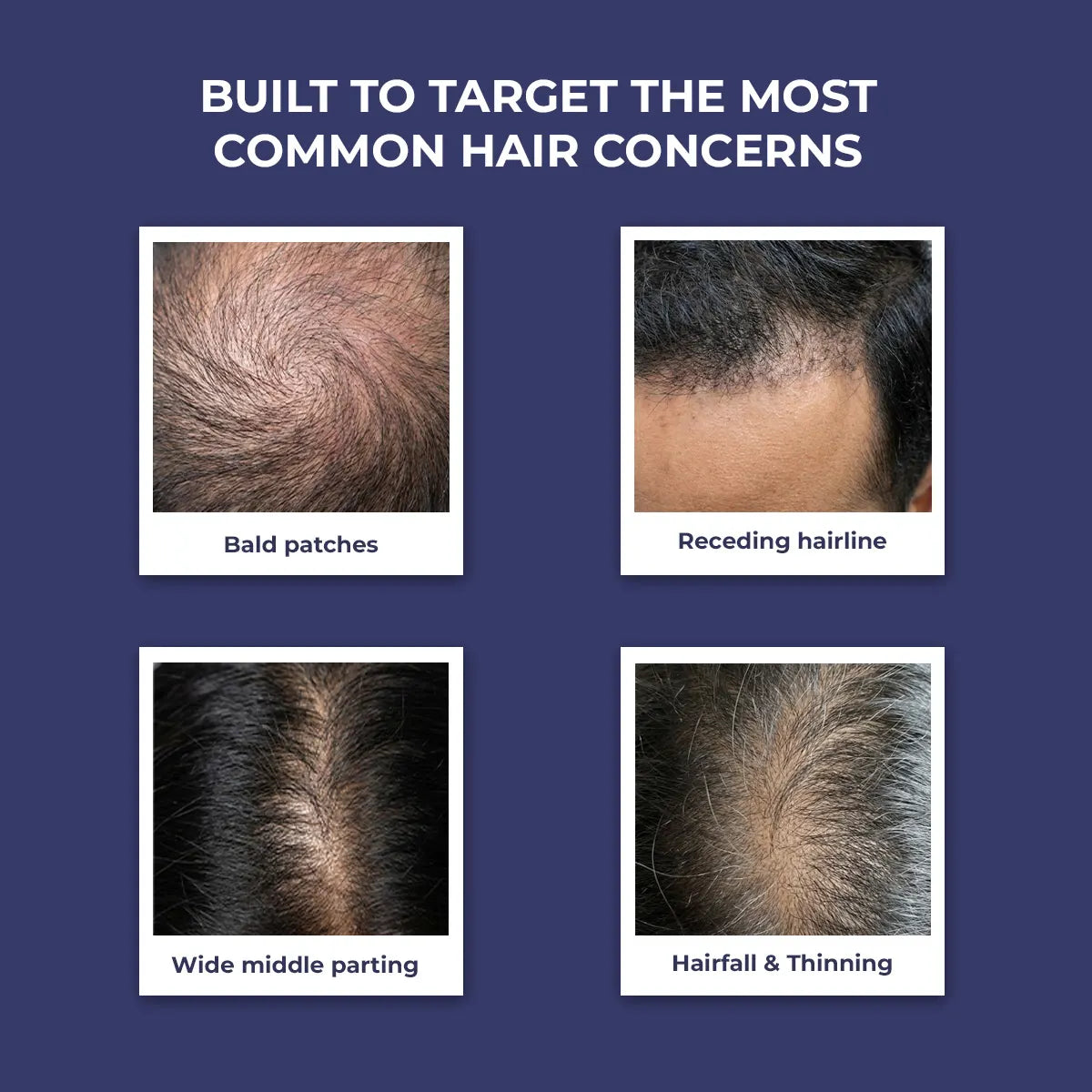 Anti-Hairfall Shampoo | 200 ml