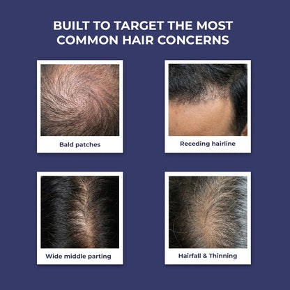 Anti-Hairfall Shampoo