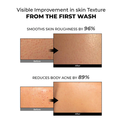 Skin Reset Exfoliating Bodywash