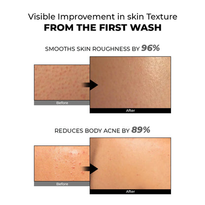 Skin Reset Exfoliating Bodywash | 300 ml