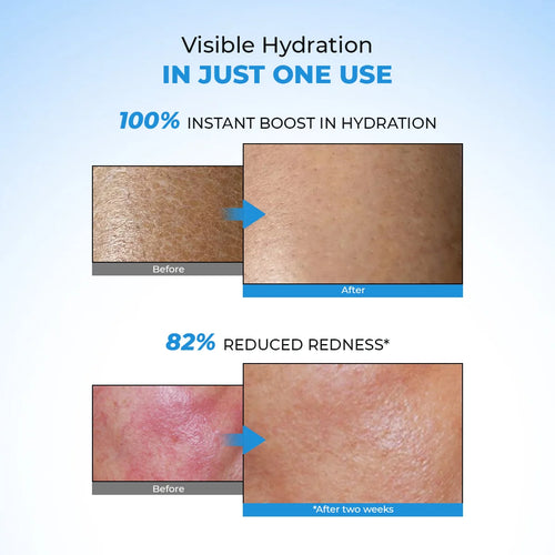 Hydro+ Multi Hyaluronic Acid Moisturiser |100 gm | Flash Sale