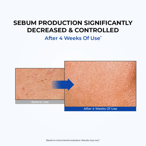 7 Ceramides Milky Toner Spray | 100 ml | Flash Sale