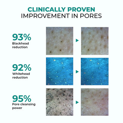 Zero Pore Ultra Light Cleanser | 2 x 50 ml | CK