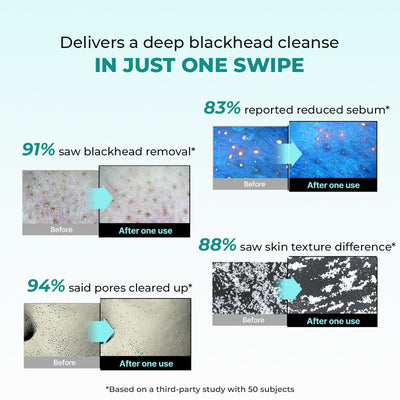 Blackhead Removal Combo | Blackhead Melting Water Mini (Pack of 2) + Blackhead Remover Toolkit | 2x50 ml + 1 Toolkit