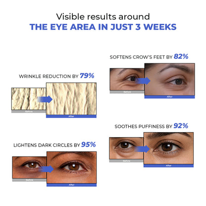 Retinol Peptide Eye Treatment Serum