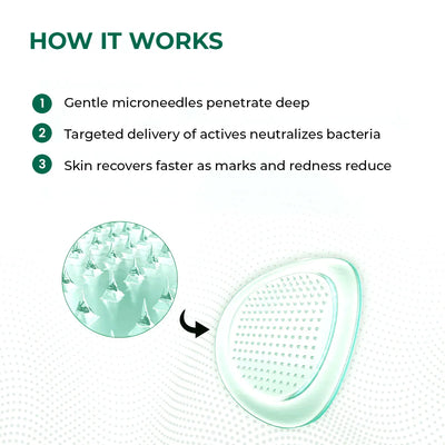 Self Dissolving Microneedle Acne Patches | 8 Patches | Super Saver Sale