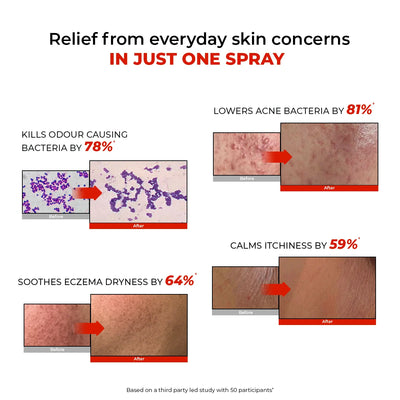 HOCL Daily Spray | Fights Body Odour, Acne & Irritation